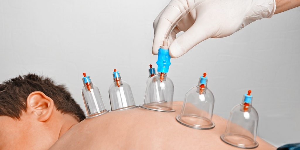  Acupuncture Doctor in karaikudi