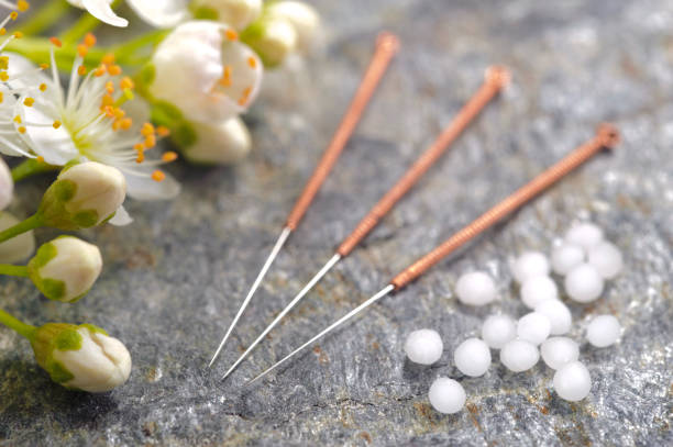 Homeo Acupuncture